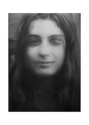 ritratto ragazza sorridente un occhio fuori orbita.jpg